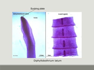 Sucking plate
Diphyllobothrium latum
 