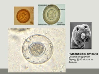 Hymenolepis diminuta
Uncommon tapeworm
Big egg @ 80 microns in
diameter
 
