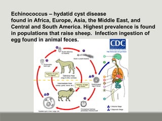 Echinococcus – hydatid cyst disease
found in Africa, Europe, Asia, the Middle East, and
Central and South America. Highest prevalence is found
in populations that raise sheep. Infection ingestion of
egg found in animal feces.
 