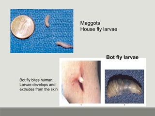 Maggots
House fly larvae
Bot fly larvae
Bot fly bites human,
Larvae develops and
extrudes from the skin
 