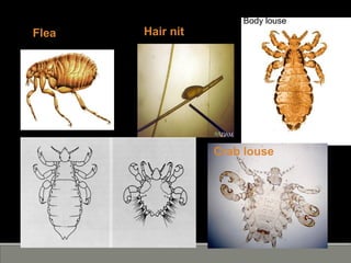 Flea
Body louse
Crab louse
Hair nit
 
