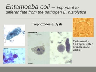 Entamoeba coli – important to
differentiate from the pathogen E. histolytica
Trophozoites & Cysts
Cysts usually
15-25µm, with 5
or more nuclei
visible.
 