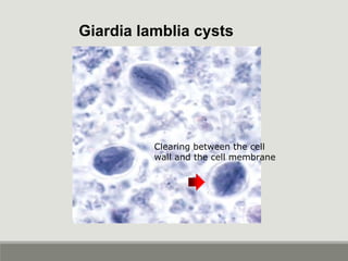 Giardia lamblia cysts
Clearing between the cell
wall and the cell membrane
 