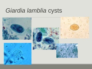 Giardia lamblia cysts
 