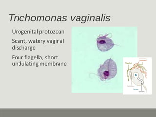Trichomonas vaginalis
Urogenital protozoan
Scant, watery vaginal
discharge
Four flagella, short
undulating membrane
 