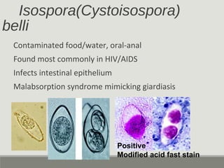 Isospora(Cystoisospora)
belli
Contaminated food/water, oral-anal
Found most commonly in HIV/AIDS
Infects intestinal epithelium
Malabsorption syndrome mimicking giardiasis
Positive
Modified acid fast stain
 
