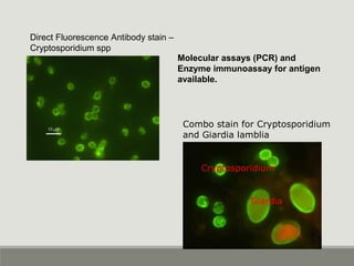 Direct Fluorescence Antibody stain –
Cryptosporidium spp
Molecular assays (PCR) and
Enzyme immunoassay for antigen
available.
Giardia
Cryptosporidium
Combo stain for Cryptosporidium
and Giardia lamblia
 