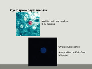 Cyclospora cayetanensis
Modified acid fast positive
8-10 microns
UV autofluorescence
Also positive on Calcofluor
white stain
 