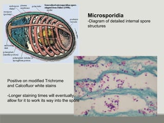 Microsporidia
-Diagram of detailed internal spore
structures
Positive on modified Trichrome
and Calcofluor white stains
-Longer staining times will eventually
allow for it to work its way into the spore
 
