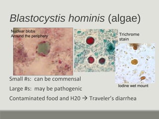 Blastocystis hominis (algae)
Small #s: can be commensal
Large #s: may be pathogenic
Contaminated food and H20  Traveler’s diarrhea
Iodine wet mount
Nuclear blobs
Around the periphery Trichrome
stain
 