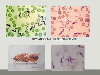 TRYPANOSOMA BRUCEI GAMBIENSE
 