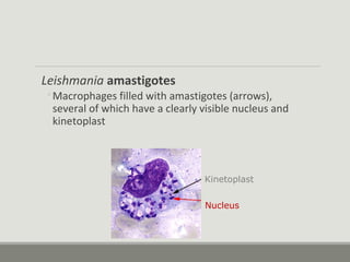 Leishmania amastigotes
◦Macrophages filled with amastigotes (arrows),
several of which have a clearly visible nucleus and
kinetoplast
Nucleus
Kinetoplast
 