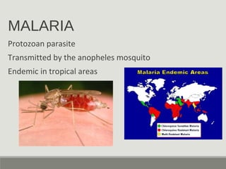 MALARIA
Protozoan parasite
Transmitted by the anopheles mosquito
Endemic in tropical areas
 