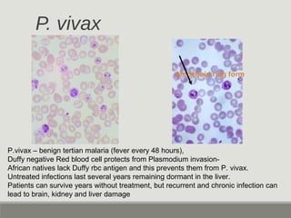 P. vivax
Amoeboid ring form
P.vivax – benign tertian malaria (fever every 48 hours),
Duffy negative Red blood cell protects from Plasmodium invasion-
African natives lack Duffy rbc antigen and this prevents them from P. vivax.
Untreated infections last several years remaining dormant in the liver.
Patients can survive years without treatment, but recurrent and chronic infection can
lead to brain, kidney and liver damage
 