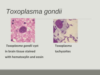 Toxoplasma gondii
Toxoplasma gondii cyst Toxoplasma
in brain tissue stained tachyzoites
with hematoxylin and eosin
 
