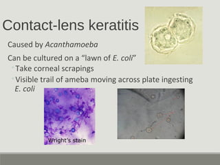 Contact-lens keratitis
Caused by Acanthamoeba
Can be cultured on a “lawn of E. coli”
◦Take corneal scrapings
◦Visible trail of ameba moving across plate ingesting
E. coli
Wright’s stain
 