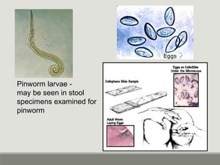 Pinworm larvae -
may be seen in stool
specimens examined for
pinworm
Eggs
 