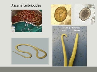 Ascaris lumbricoides
 