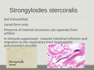 Strongyloides stercoralis
Soil transmitted
Larval form only
Presence of internal structures can separate from
artifact
In immune suppressed - massive intestinal infection and
migration to the respiratory tract (eosinophilic
pneumoniae) possible
Strongyloides
larvae
 