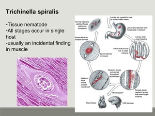 Trichinella spiralis
-Tissue nematode
-All stages occur in single
host
-usually an incidental finding
in muscle
 