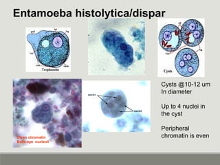 Entamoeba histolytica/dispar
Cysts @10-12 um
In diameter
Up to 4 nuclei in
the cyst
Peripheral
chromatin is evenClean chro...
