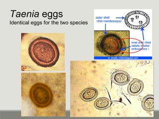 Hymenolepis diminuta
Uncommon tapeworm
Big egg @ 80 microns in
diameter
 