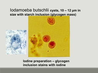 Iodamoeba butschlii cysts, 10 – 12 µm in
size with starch inclusion (glycogen mass)
Iodine preparation – glycogen
inclusio...