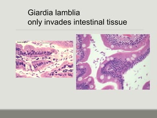 Giardia lamblia
only invades intestinal tissue
 
