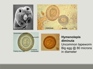 Relative size of Helminth
eggs
http://www2.bc.cc.ca.us/bio16/pal/Parasitology.htm
 