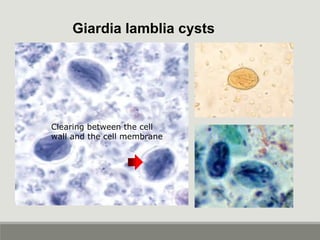 Giardia lamblia cysts
Clearing between the cell
wall and the cell membrane
 