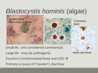 Blastocystis hominis (algae)
Small #s: are considered commensal
Large #s: may be pathogenic
Found in Contaminated food and...