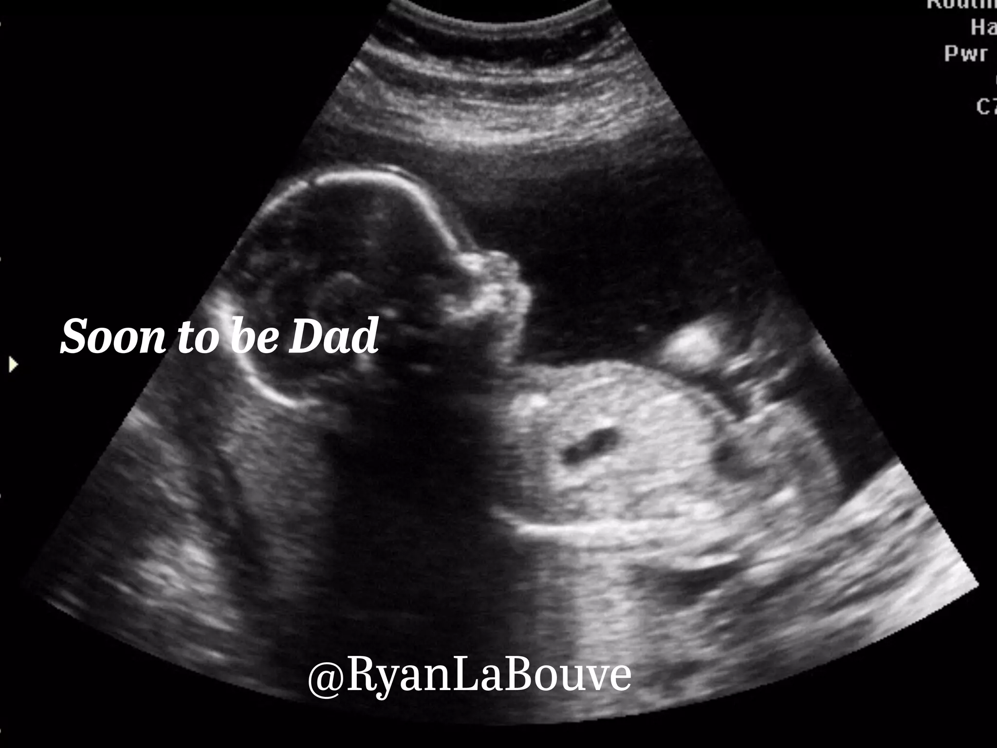 Soon to be Dad
@RyanLaBouve
 