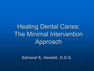 Healing Dental Caries:
The Minimal Intervention
Approach
Edmond R. Hewlett. D.D.S.
 