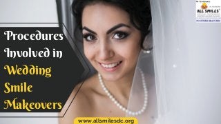 Procedures
Involved in
Wedding
Smile
Makeovers
www.allsmilesdc.org
 