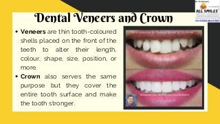Dental Veneers and Crown
Veneers are thin tooth-coloured
shells placed on the front of the
teeth to alter their length,
colour, shape, size, position, or
more.
Crown also serves the same
purpose but they cover the
entire tooth surface and make
the tooth stronger.
 