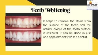 Teeth Whitening
It helps to remove the stains from
the surface of the tooth and the
natural colour of the tooth surface
is restored. It can be done in just
one appointment with the dentist.
 