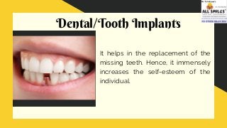 Dental/Tooth Implants
It helps in the replacement of the
missing teeth. Hence, it immensely
increases the self-esteem of the
individual.
 