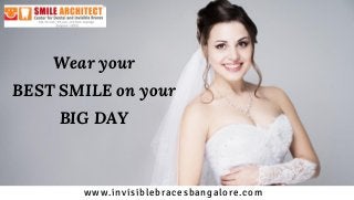 Wear your
BEST SMILE on your
BIG DAY
www.invisiblebracesbangalore.com
 