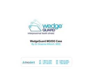 WedgeGuard MO/DO Case By Dr Graeme Milicich, BDS 