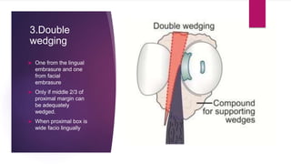 3.Double
wedging
 One from the lingual
embrasure and one
from facial
embrasure
 Only if middle 2/3 of
proximal margin can
be adequately
wedged.
 When proximal box is
wide facio lingually
 