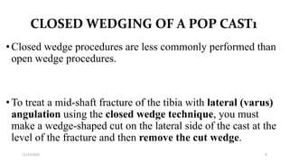 Wedging of pop.pptx