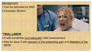 Management:
1.Can be delivered by NSD
2.Cesarean Section
*TRIAL LABOR
If with borderline (just adequate) inlet measurement
May be done if with descent of the presenting part and dilatation of the
cervix
 