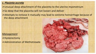 c. Placenta accreta
Unusual deep attachment of the placenta to the uterine myometrium
So deep that the placenta will not loosen and deliver
Attempts to remove it manually may lead to extreme hemorrhage because of
the deep attachment
Management
Hysterectomy Dependent Intervention
Administration of Methotrexate
 
