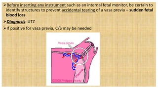 Before inserting any instrument such as an internal fetal monitor, be certain to
identify structures to prevent accidental tearing of a vasa previa – sudden fetal
blood loss
Diagnosis: UTZ
If positive for vasa previa, C/S may be needed
 