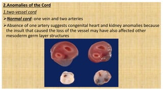 2.Anomalies of the Cord
1.two-vessel cord
Normal cord: one vein and two arteries
Absence of one artery suggests congenital heart and kidney anomalies because
the insult that caused the loss of the vessel may have also affected other
mesoderm germ layer structures
 
