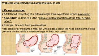 Problems with fetal position, presentation, or size
1.Face presentation
A fetal head presenting at a different angle than expected is termed asynclitism
• Asynclitism is defined as the "oblique malpresentation of the fetal head in
labor".
Example: face and brow presentations
*face (chin or or mentum) is rare, but when it does occur, the head diameter the fetus
presents on the pelvis is often too large for birth to proceed.
 