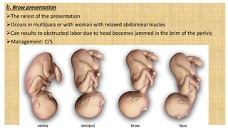 b. Brow presentation
The rarest of the presentation
Occurs in multipara or with woman with relaxed abdominal mucles
Can results to obstructed labor due to head becomes jammed in the brim of the perlvis
Management: C/S
 