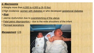 d. Macrosomia
Weighs more than 4,000 to 4,500 g (9-10 lbs)
High incidence: women with diabetes or who developed gestational diabetes
Risk:
• uterine dysfunction due to overstretching of the uterus
• Fetal pelvic disproportion – due to the wide shoulders of the infant
• Perineal lacerations
Management: C/S
 