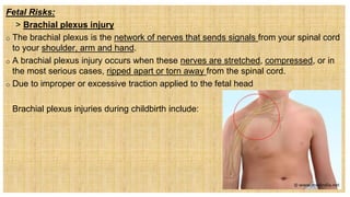 Fetal Risks:
 > Brachial plexus injury
o The brachial plexus is the network of nerves that sends signals from your spinal cord
to your shoulder, arm and hand.
o A brachial plexus injury occurs when these nerves are stretched, compressed, or in
the most serious cases, ripped apart or torn away from the spinal cord.
o Due to improper or excessive traction applied to the fetal head
• Brachial plexus injuries during childbirth include:
 