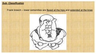 Sub- Classification
1. Frank breech – lower extremities are flexed at the hips and extended at the knee
 